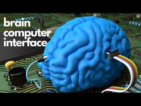 Breakthrough Brain Implant Converts Imagination To Text