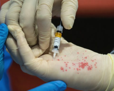 Measles Outbreak Hits Texas as Vaccination Rates Lag